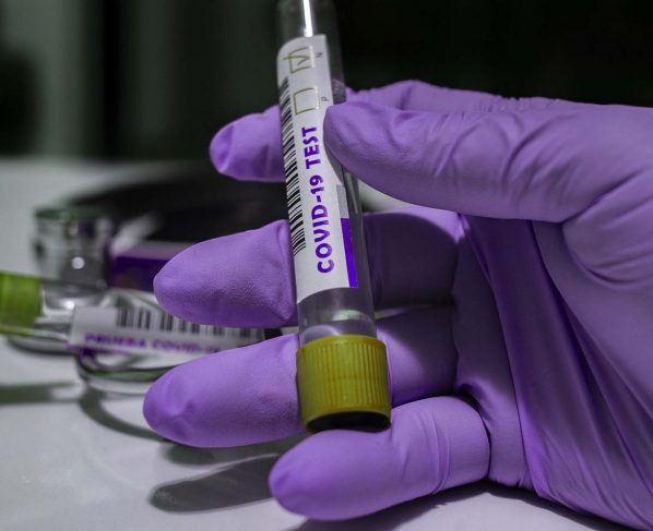 Número de infectados de COVID-19 se dispara en las últimas 24 horas a 152 nuevos casos