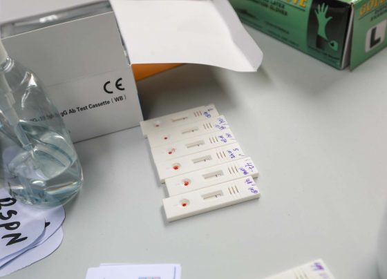 A 1,477 se eleva la cifra de infectados por COVID-19