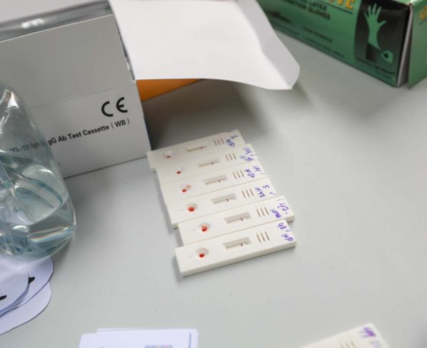 A 1,477 se eleva la cifra de infectados por COVID-19