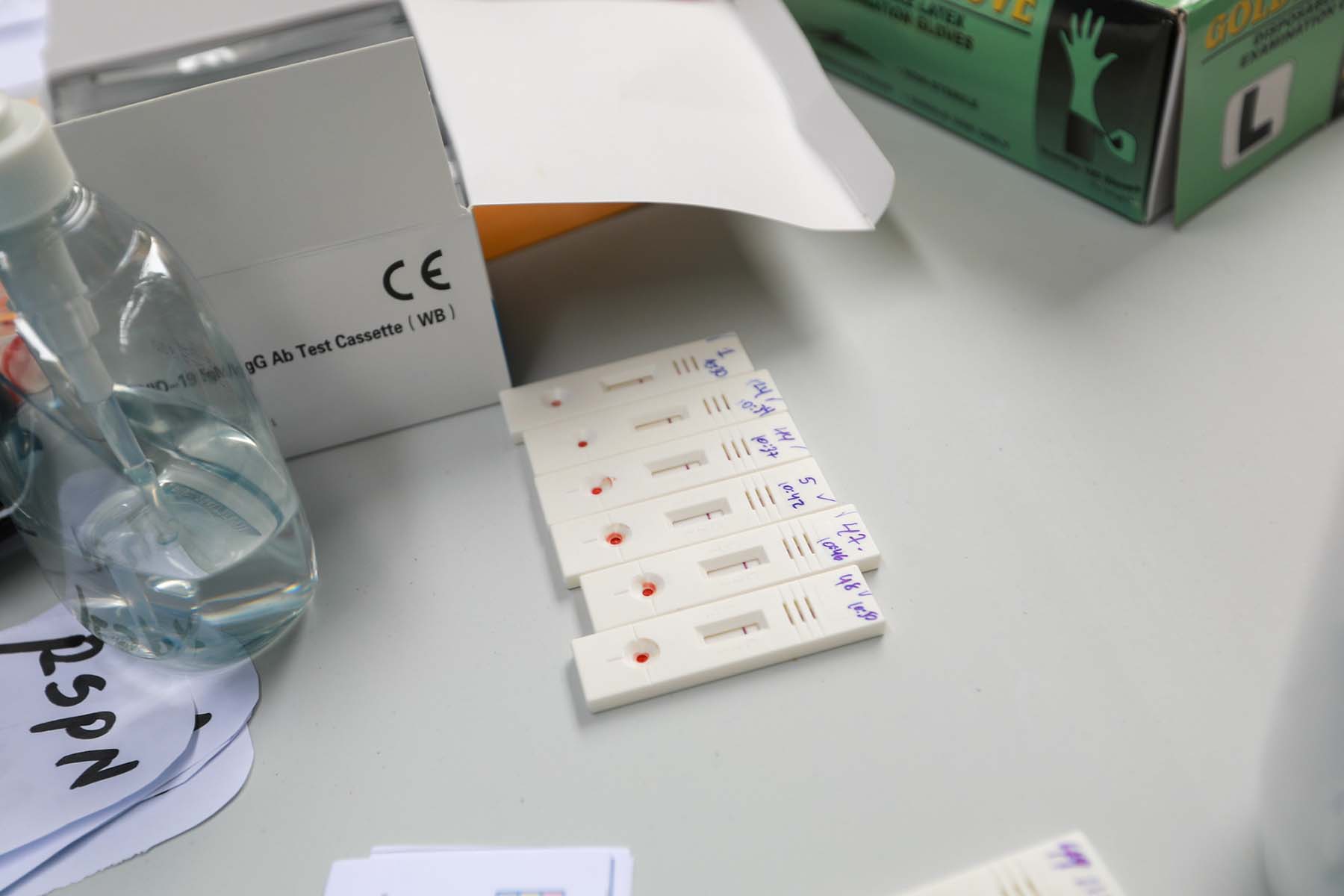 A 1,477 se eleva la cifra de infectados por COVID-19