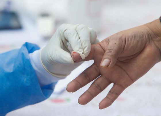 Minsa: casos positivos de COVID-19 en Ica se elevó a 9,386