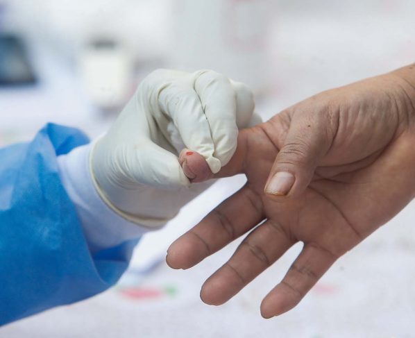 Minsa: casos positivos de COVID-19 en Ica se elevó a 9,386