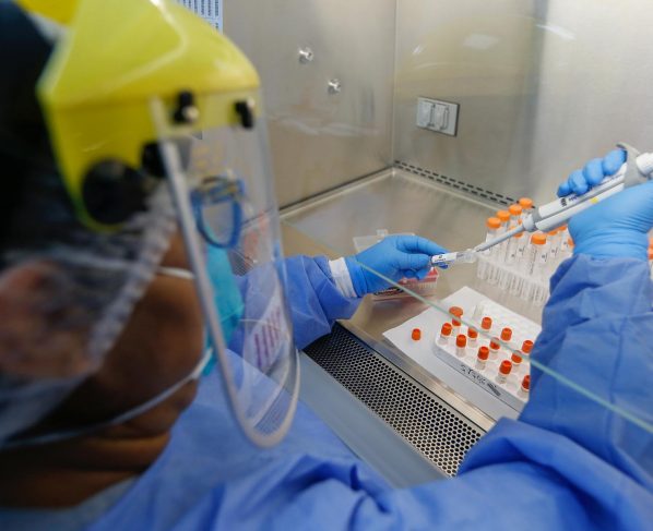 Perú registra 613,378 contagiados y 28,124 fallecidos por COVID-19
