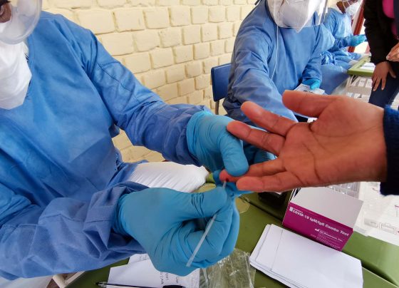 Casos confirmados por coronavirus COVID-19 ascienden a 729,619 en el Perú