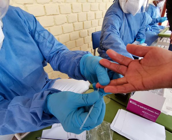 Casos confirmados por coronavirus COVID-19 ascienden a 729,619 en el Perú