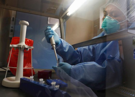 Perú suma otros 1.012 casos y 44 fallecidos por la covid-19